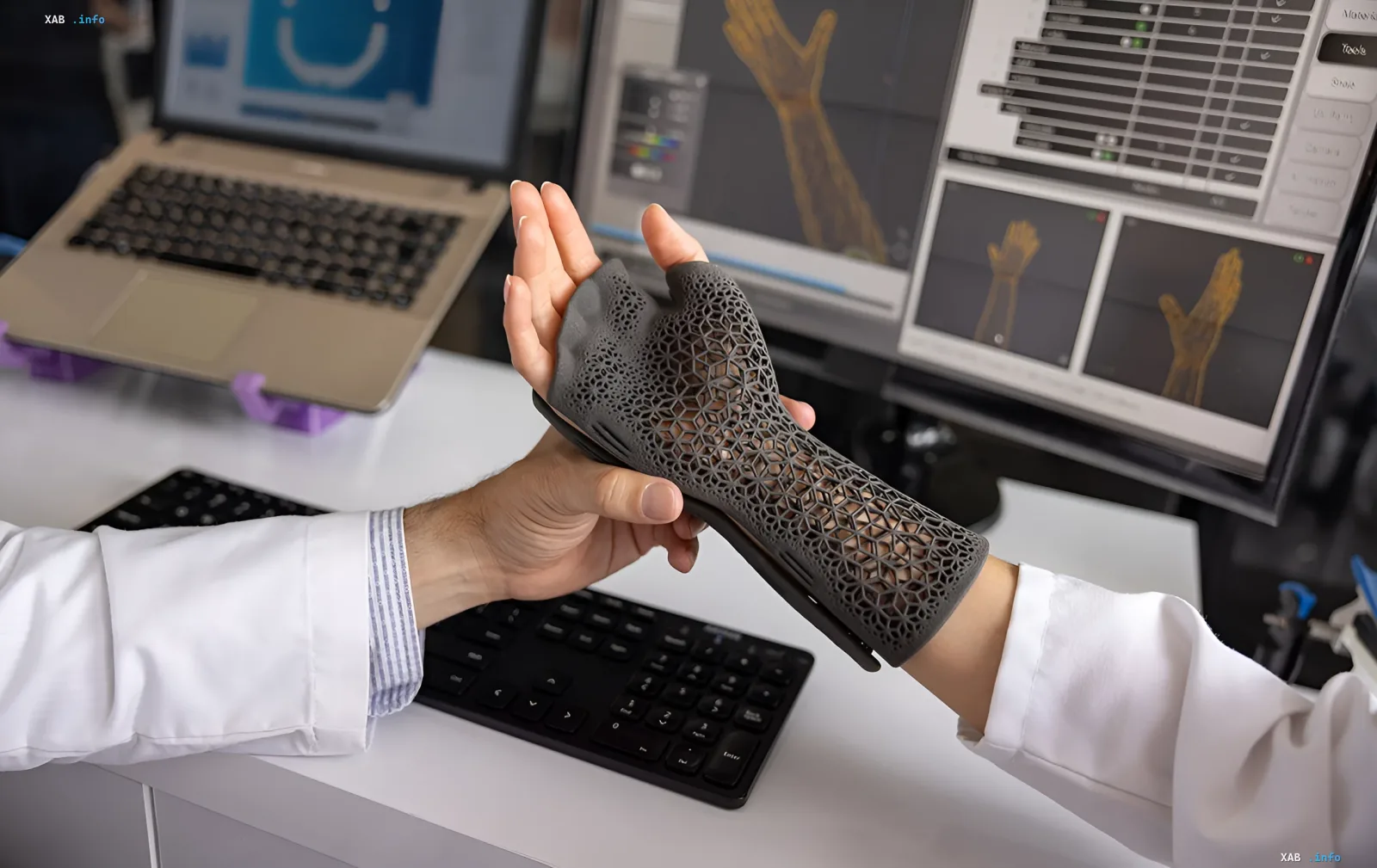 Специалист в белом халате держит 3D-печатный протез руки, демонстрируя инновационные технологии для раненых