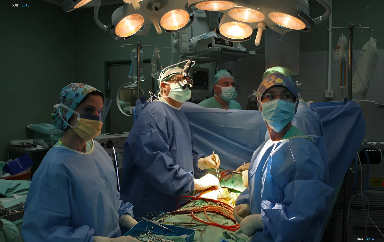 Surgical team performing a complex heart transplant surgery on a child in an operating room