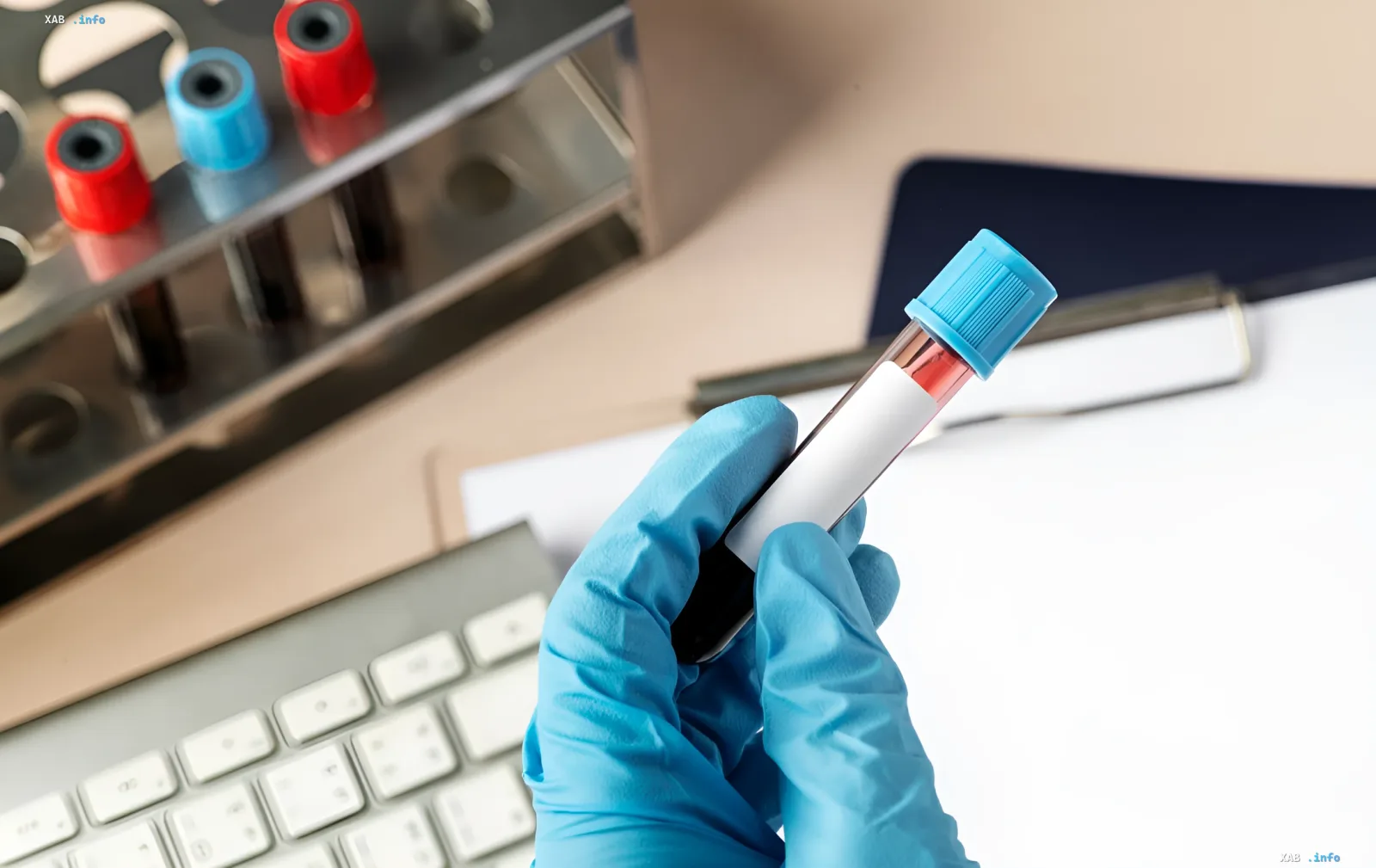 Geneticist in a blue glove holding a blood sample tube for a DNA cancer predisposition test in a laboratory