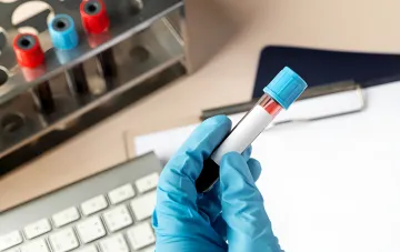 Geneticist in a blue glove holding a blood sample tube for a DNA cancer predisposition test in a laboratory